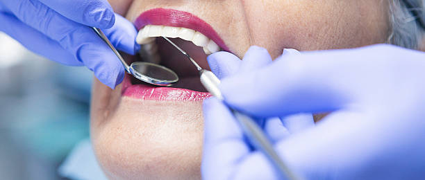 Best Emergency Dentist for Knocked-Out Tooth in Lake Morton Berrydale, WA